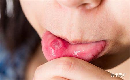 锌硒宝婴儿能吃么（儿童吃锌硒宝可以改善吃饭吗）-硒宝网