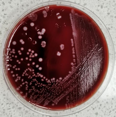 锌硒宝 药理作用(锌药片)-硒宝网