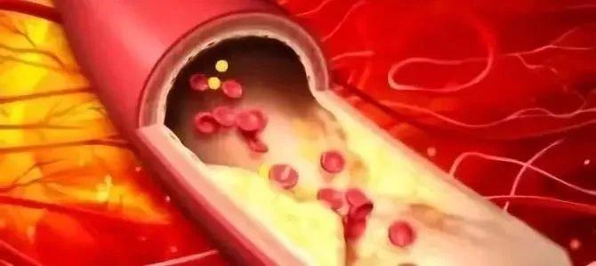 静脉补钙（静脉补钙用什么药）-硒宝网