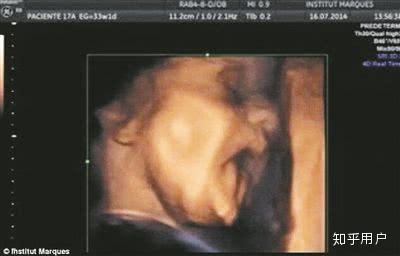 孕妇吃锌硒宝多久(孕妇吃锌硒宝片有副作用吗)-硒宝网