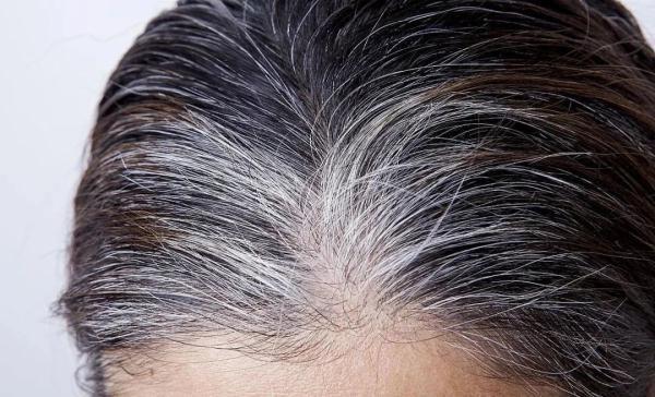 掉头发是缺少什么微量元素（缺少微量掉头发元素是什么意思）-硒宝网