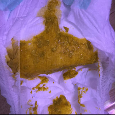 一岁宝宝查微量元素怎么查(查微量元素宝宝啥都不缺)-硒宝网