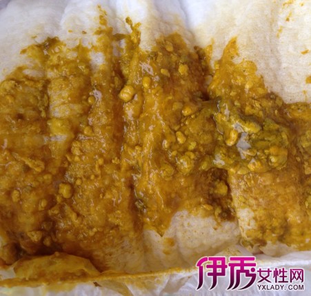 锌硒宝片治疗脱发（脱发吃锌硒宝有效吗）-硒宝网