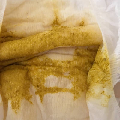 锌硒宝片治疗脱发（脱发吃锌硒宝有效吗）-硒宝网