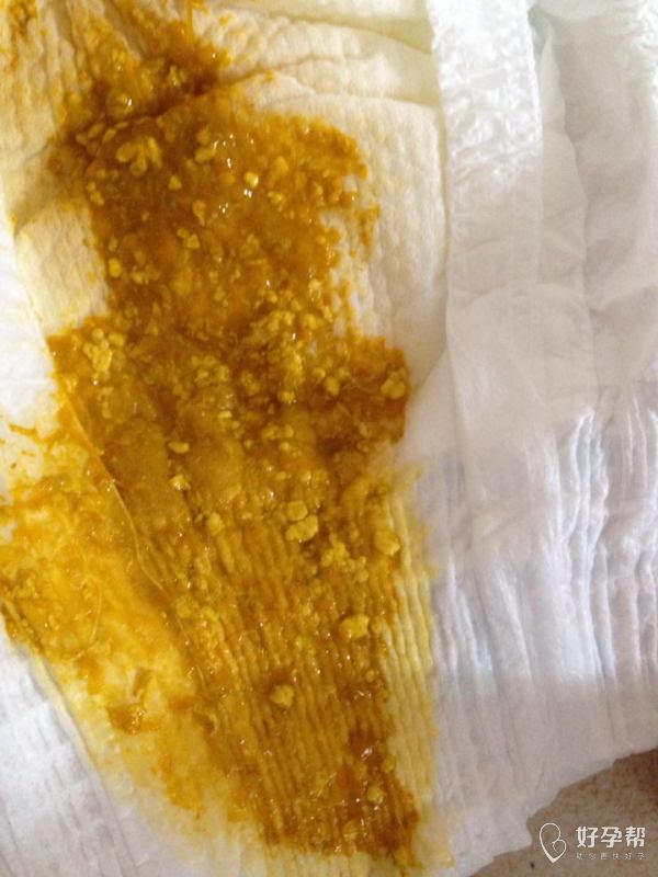 锌硒宝片治疗脱发（脱发吃锌硒宝有效吗）-硒宝网