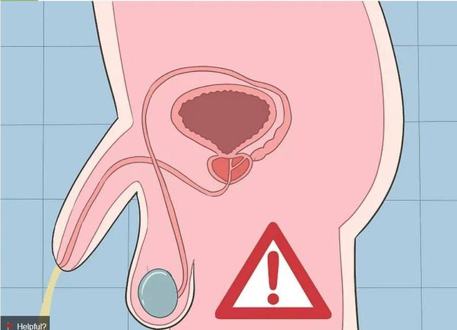 锌硒宝对男人好吗（锌硒宝对男人）-硒宝网