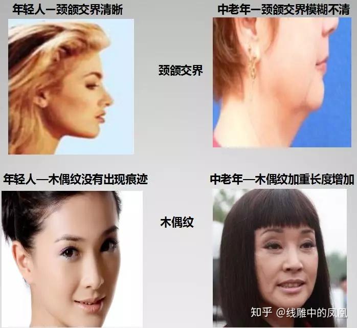 补钙面部会衰老得慢些吗（缺钙会引起脸部衰老吗）-硒宝网