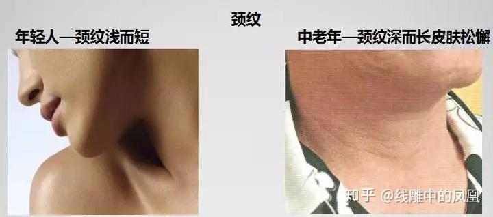 补钙面部会衰老得慢些吗（缺钙会引起脸部衰老吗）-硒宝网