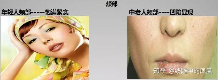 补钙面部会衰老得慢些吗（缺钙会引起脸部衰老吗）-硒宝网