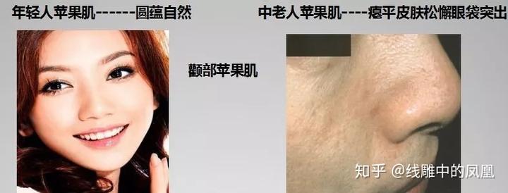 补钙面部会衰老得慢些吗（缺钙会引起脸部衰老吗）-硒宝网