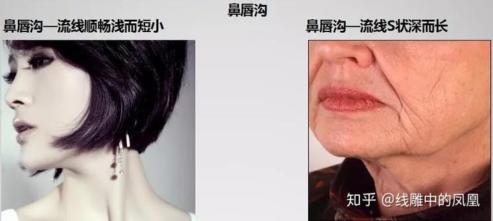 补钙面部会衰老得慢些吗（缺钙会引起脸部衰老吗）-硒宝网