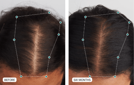 锌硒宝 那儿有卖(锌硒宝是保健品吗)-硒宝网