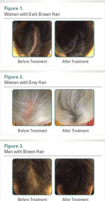 锌硒宝 那儿有卖(锌硒宝是保健品吗)-硒宝网