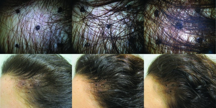 锌硒宝 那儿有卖(锌硒宝是保健品吗)-硒宝网