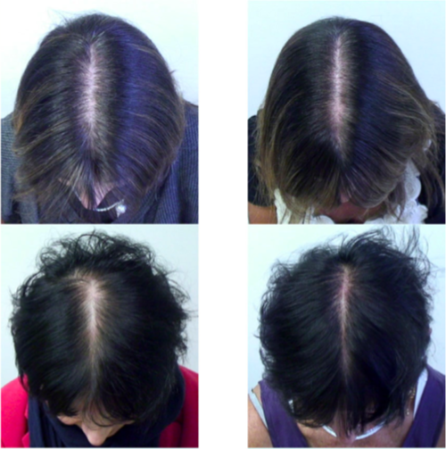 锌硒宝 那儿有卖(锌硒宝是保健品吗)-硒宝网