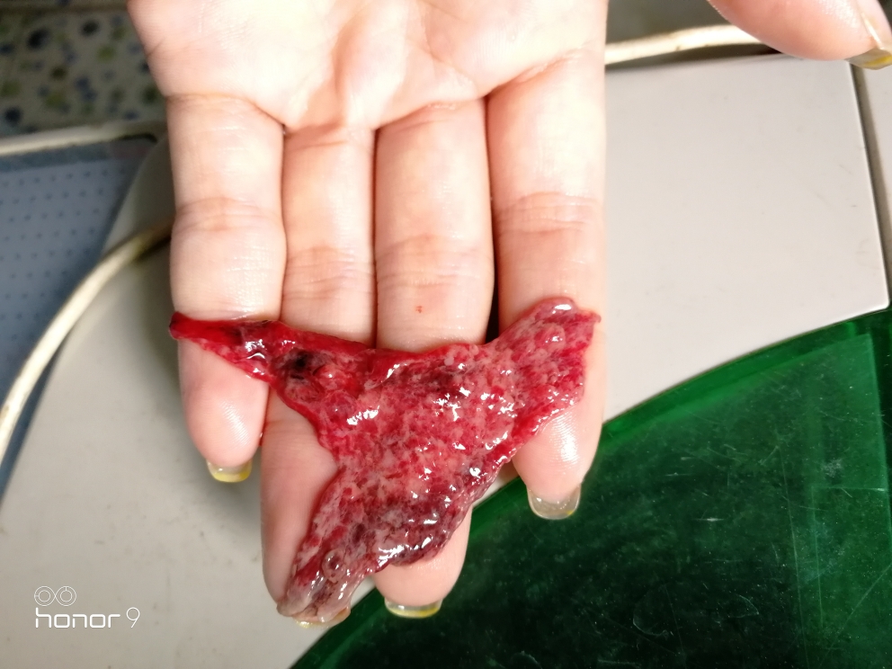 锌硒宝片吃完恶心（吃了锌硒宝可以喝酒吗）-硒宝网