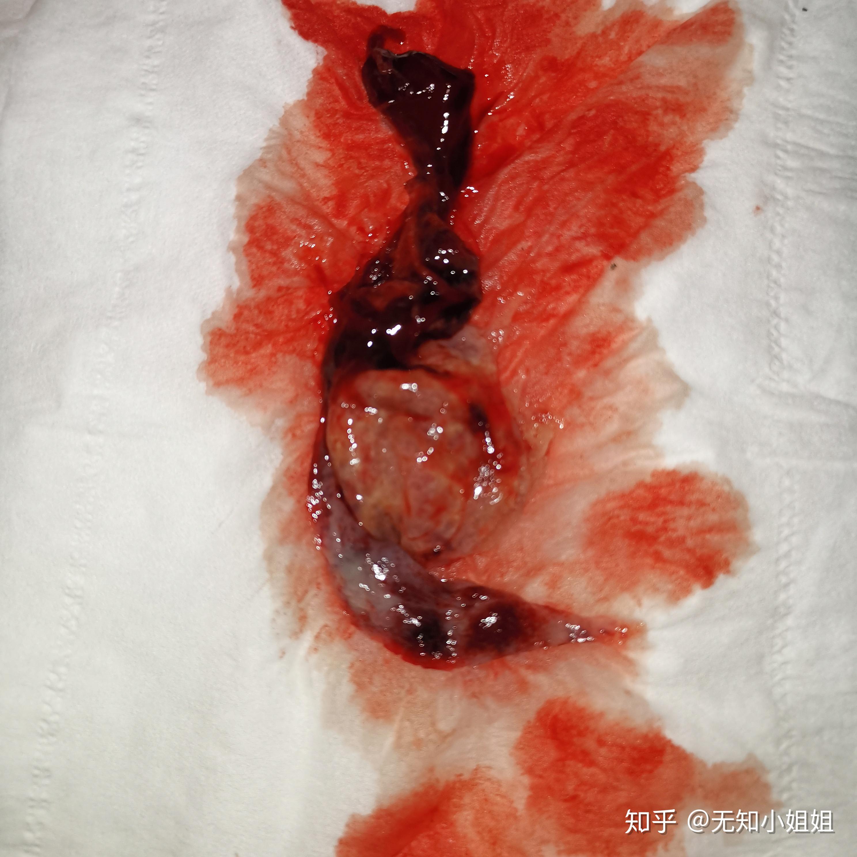 锌硒宝片吃完恶心（吃了锌硒宝可以喝酒吗）-硒宝网