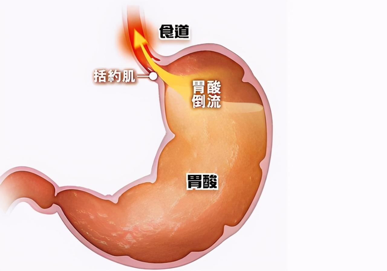 不伤胃的补铁药有哪些（补铁的药对胃有刺激吗）-硒宝网