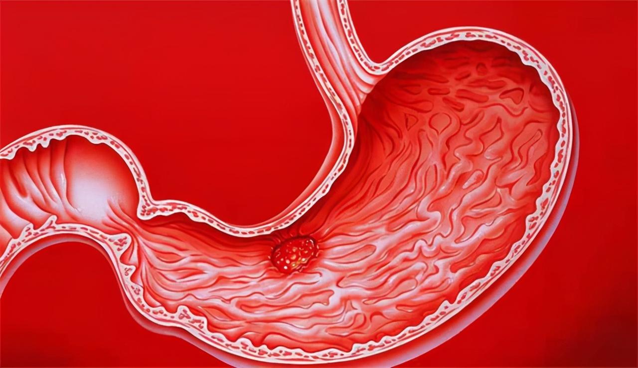 不伤胃的补铁药有哪些（补铁的药对胃有刺激吗）-硒宝网
