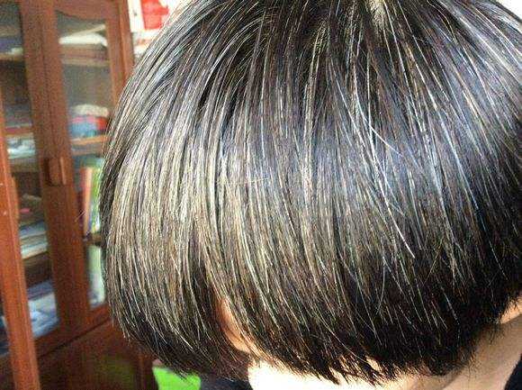 白头发是缺什么微量元素（缺微量元素引起的白发多久能好）-硒宝网