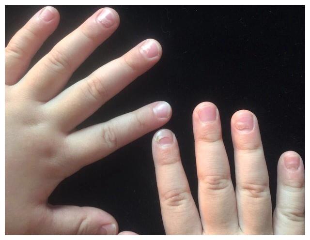 贫血可以吃锌硒宝（锌硒宝可以吞服吗）-硒宝网