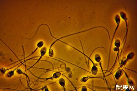 锌硒宝对男性精子(锌硒宝男性)-硒宝网