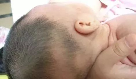 宝宝什么季节补钙最好（季节补钙宝宝好不好）-硒宝网