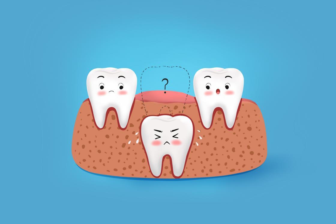补钙有什么作用（补钙是起什么作用的）-硒宝网