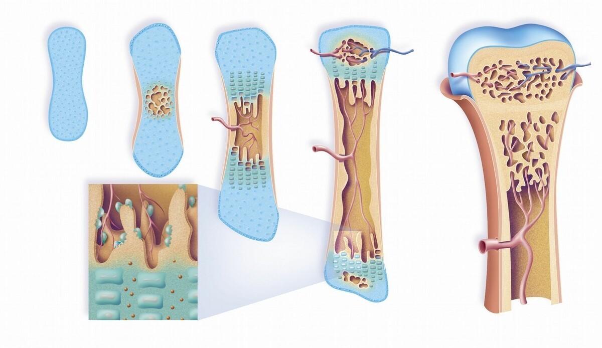 肾结石可以补钙吗(肾结石补钙可以用哪种钙片儿)-硒宝网