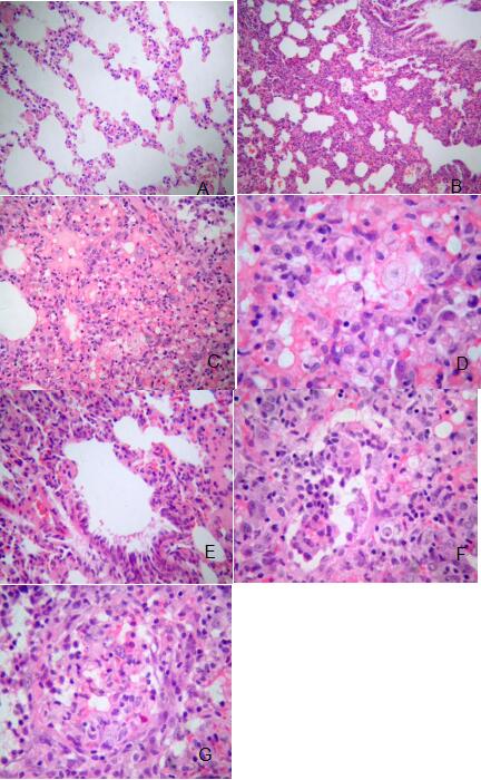 锌硒宝缺铁性贫血(锌贫血宝性缺铁硒多少)-硒宝网