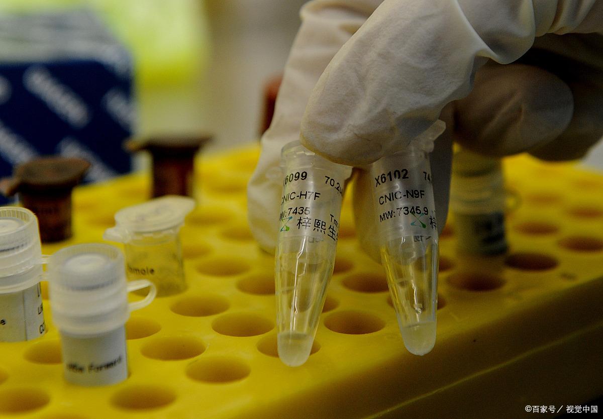 查微量元素有用吗（查微量元素有铅这一项吗）-硒宝网