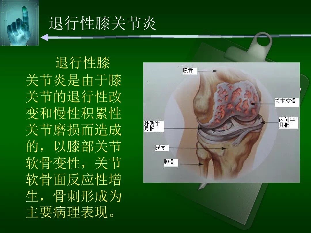 膝盖疼补钙管用吗(膝盖疼补啥钙)-硒宝网