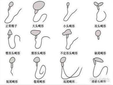精子畸形率锌硒宝（精子正常可以吃锌硒宝吗）-硒宝网