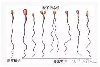 精子畸形率锌硒宝(锌硒宝能提高精子吗)-硒宝网