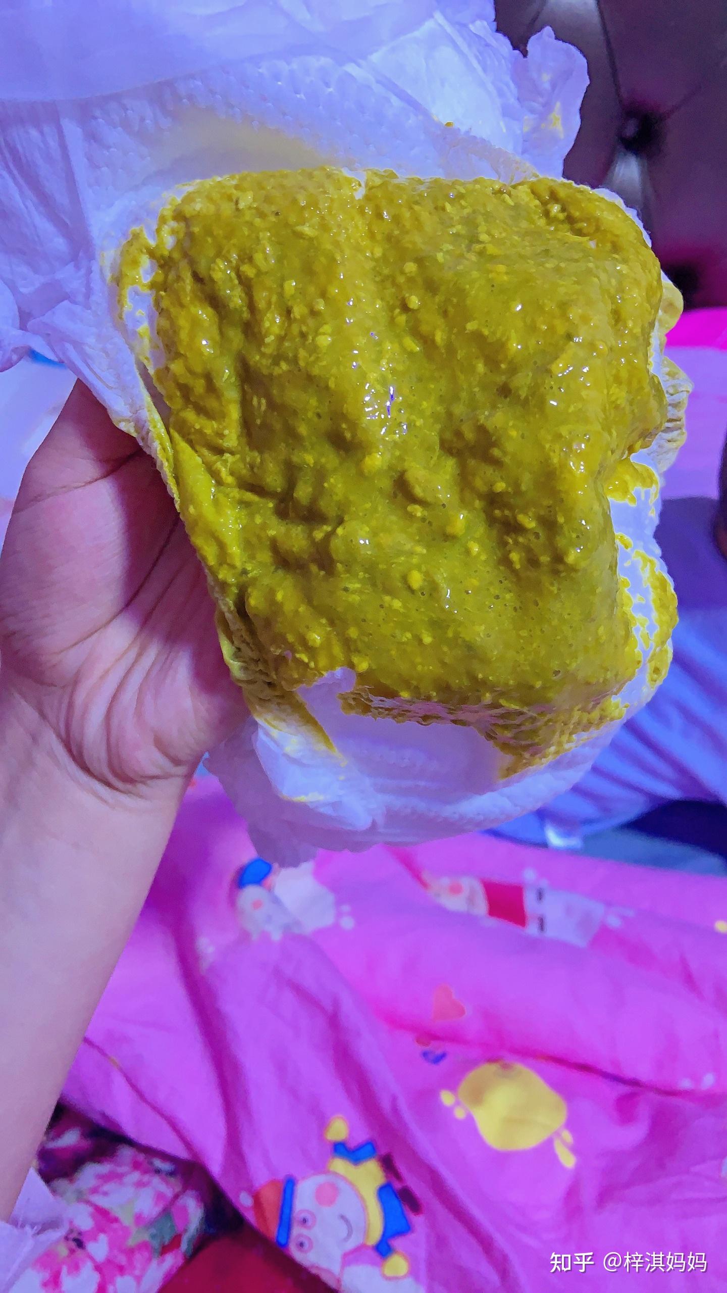 宝宝腹泻吃锌硒宝(锌硒宝宝宝吃了有什么效果)-硒宝网