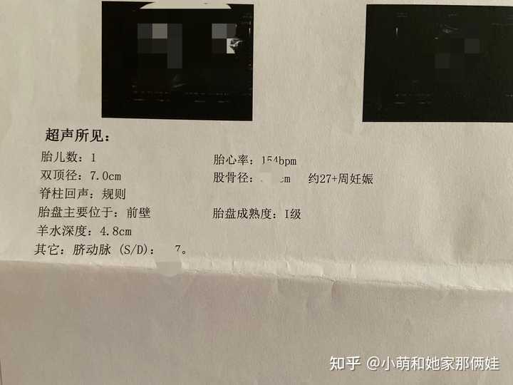 孕晚期还需要补钙吗(孕晚期补钙需要一直吃到生产吗)-硒宝网