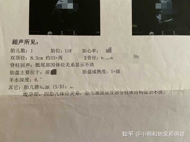 孕晚期还需要补钙吗(孕晚期补钙需要一直吃到生产吗)-硒宝网