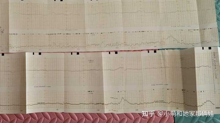 孕晚期还需要补钙吗(孕晚期补钙需要一直吃到生产吗)-硒宝网
