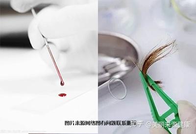 微量元素查什么(查微量元素需要空腹抽血吗)-硒宝网