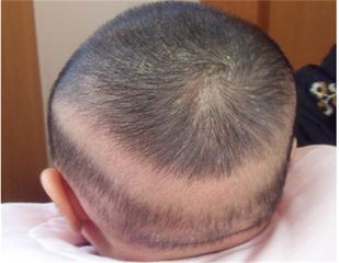 微量元素查什么（查微量元素多少钱）-硒宝网