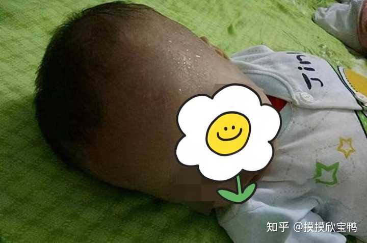 孩子补钙什么牌子好(比较好的儿童补钙产品)-硒宝网