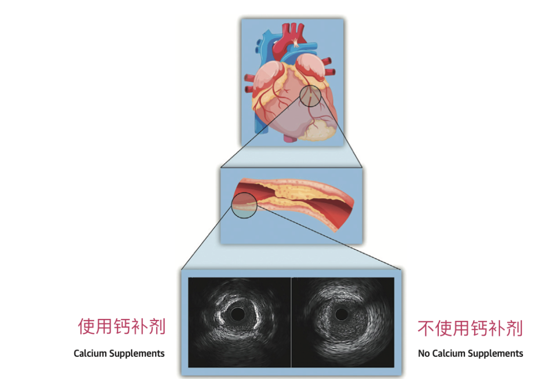 喝豆浆补钙吗（喝豆浆补钙不）-硒宝网