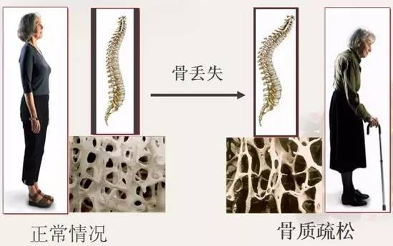 更年期如何补钙（更年期补钙补多长时间）-硒宝网