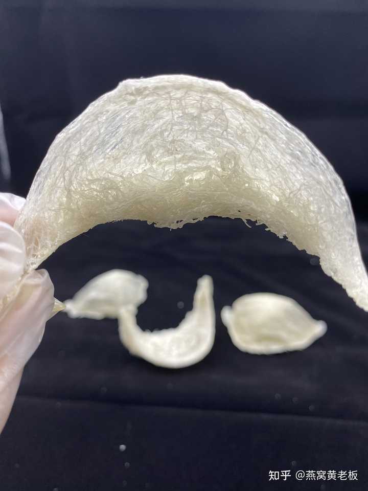 孕期什么时候补铁最好（孕期补铁好处）-硒宝网