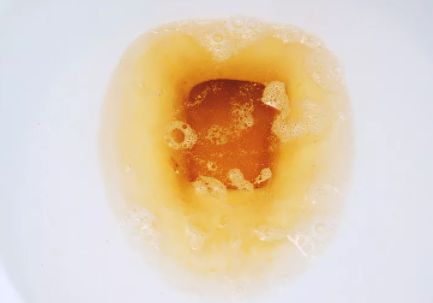 尿酸高能补钙吗(尿酸高可不可以补钙吃钙片)-硒宝网