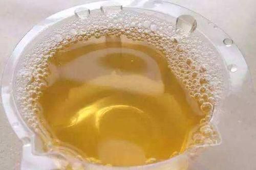 尿酸高能补钙吗(尿酸高可不可以补钙吃钙片)-硒宝网