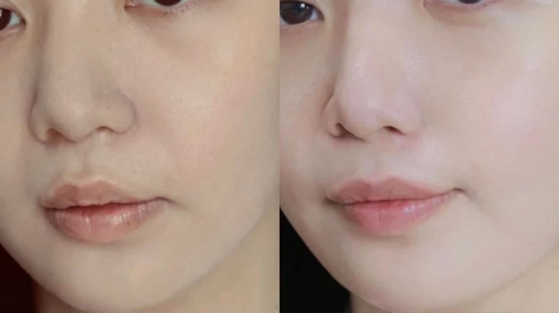 喜倍力锌硒宝成人（禧力得牌锌硒胶囊）-硒宝网