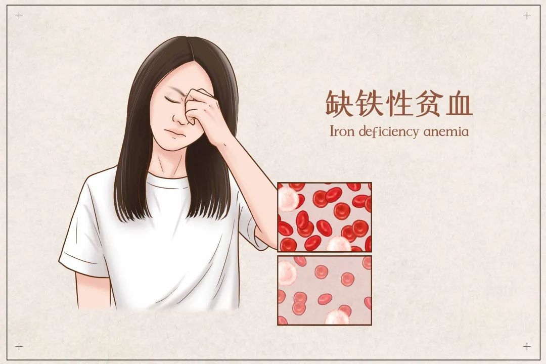 为什么吃补铁的药大便是黑色的（大便黑色证明补铁吸收不好吗）-硒宝网