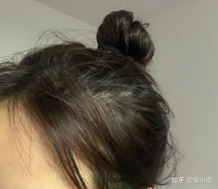 脱发补锌有用吗（脱发补锌用有什么好处）-硒宝网