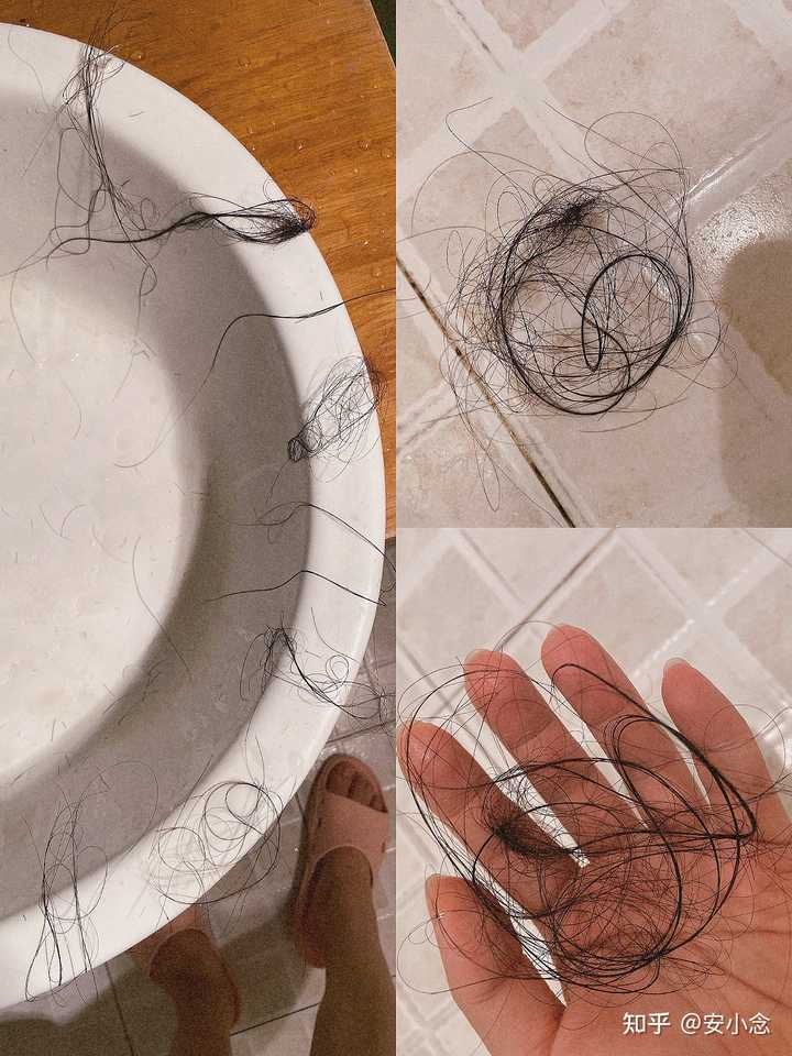 脱发补锌有用吗（脱发补锌用有什么好处）-硒宝网